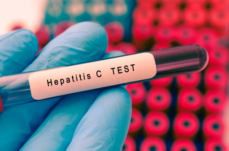 Testare gratuită la hepatite B, C și D în scuarul Catedralei Mitropolitane din Chișinău