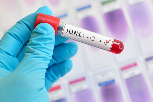 Un bărbat din Chișinău a decedat de gripa A(H1N1). S-au înregistrat și patru cazuri de COVID
